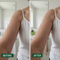 CLEANSPARK - Crepey Skin Repair Cream