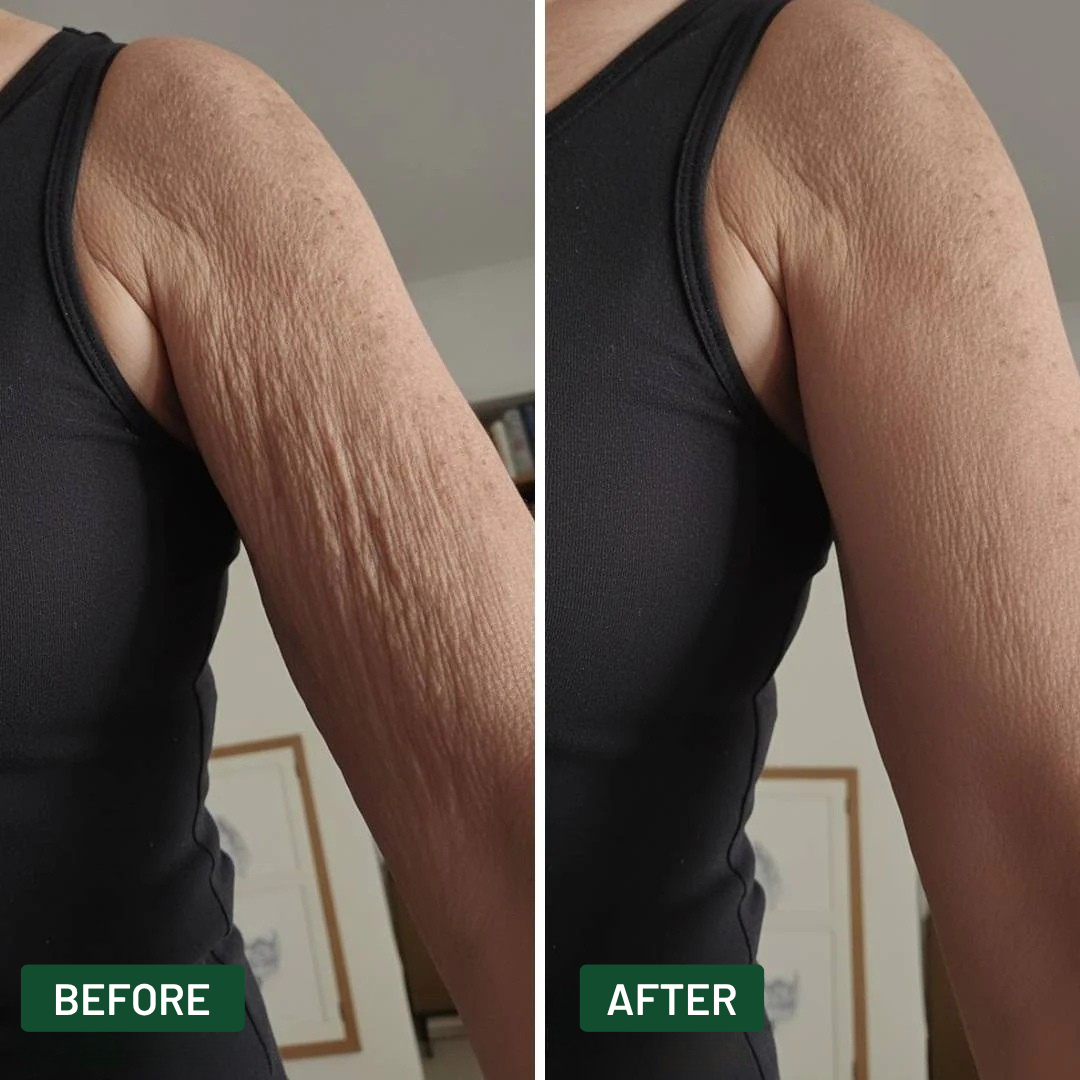 CLEANSPARK - Crepey Skin Repair Cream