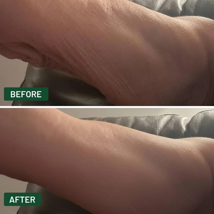 CLEANSPARK - Crepey Skin Repair Cream