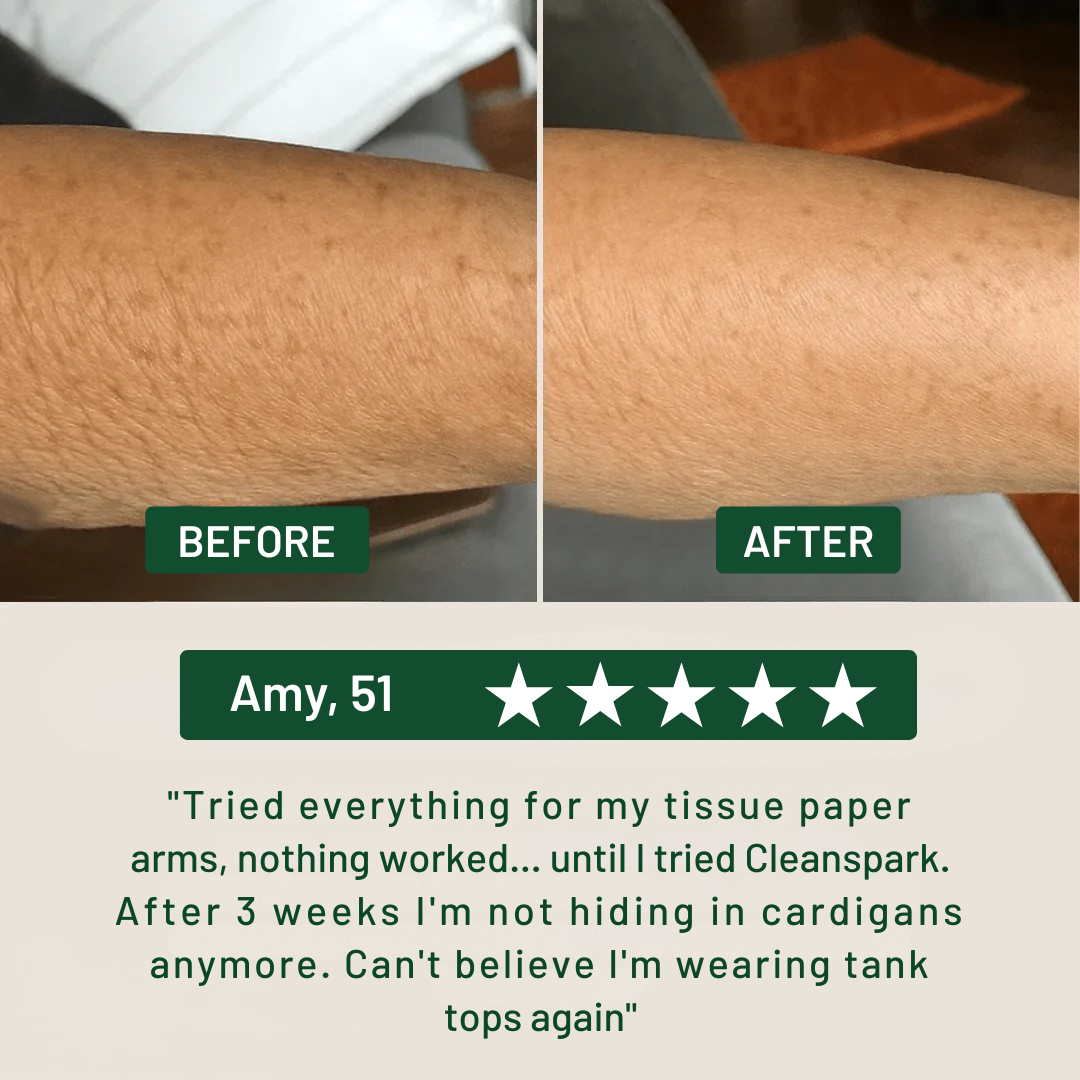 Crepey Skin Repair Cream